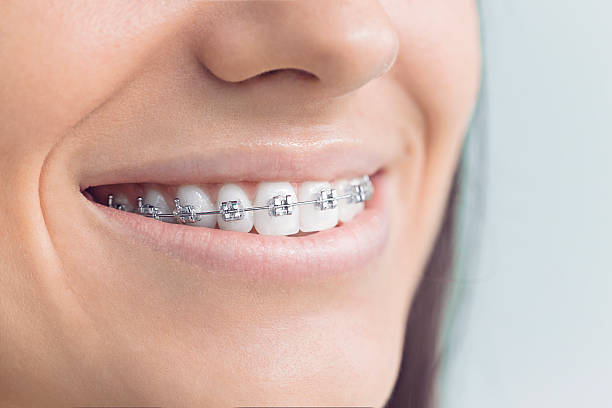 Best Invisalign and Clear Aligners  in South Daytona, FL